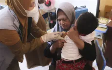 Dịch sởi bùng phát tại Indonesia, ít nhất 17 người tử vong