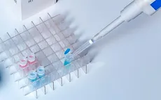 Nga chế tạo bộ xét nghiệm phát hiện 25 loại virus đường hô hấp