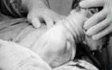 Em bé chào đời an toàn dù dây rốn quấn cổ tới 4 vòng