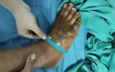Cấp cứu kịp thời cứu sống bệnh nhân bị rắn độc cắn
