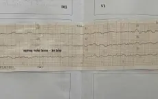 Nữ sinh 18 tuổi ngưng tim sau khi bơi, may mắn được cứu sống