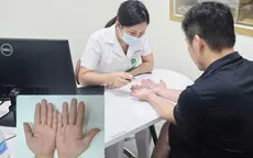 Cảnh báo bệnh về da mùa mưa lũ