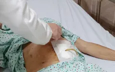Bỏng thực quản vì uống nhầm nước tro tàu