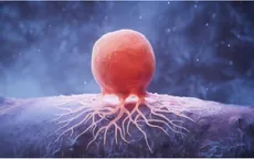 Phát hiện giảm chất béo có thể ức chế tế bào ung thư vú