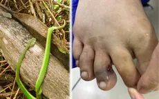 Cảnh báo gia tăng số ca bị rắn lục cắn