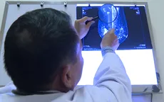 Ung thư vú thể tam âm: Từ thể bệnh "khó trị" đến cánh cửa hy vọng mới