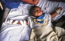 Gia tăng số ca mắc tả tại hơn 30 quốc gia, WHO cảnh báo về nguy cơ lan rộng