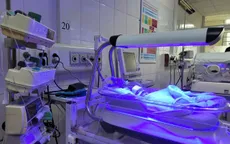 47 ngày hồi sinh bệnh nhi mềm khí quản bẩm sinh