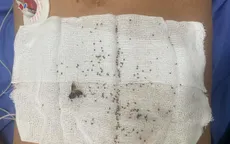 Thoát chết sau khi bị hơn 300 con ong khoái đốt