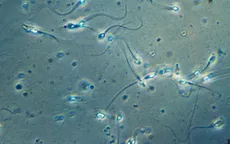 Ca mang thai đầu tiên trên thế giới nhờ phương pháp thu hồi tinh trùng do AI hỗ trợ