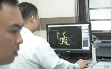 Từng bị đột quỵ 2 năm trước, bệnh nhân vẫn nhập viện muộn: Báo động tâm lý chủ quan