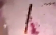 Nam thanh niên 17 tuổi ở Lâm Đồng bị chém đứt lìa bàn tay