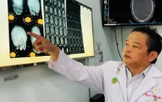 Nỗ lực phẫu thuật tạo hình sọ mặt giúp trẻ bị dính khớp sọ phát triển bình thường