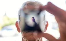 Viêm não tự miễn - căn bệnh hiếm gặp cướp đi ký ức của người bệnh 