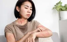 Infographic: Những yếu tố khiến bạn nổi mề đay