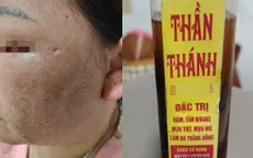 Cảnh báo nguy cơ tổn thương da do dùng "thuốc bôi thần thánh" trôi nổi