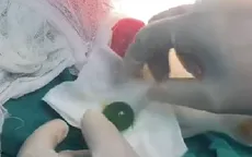 Bé 13 tháng tắc ruột vì nuốt hạt nở