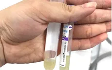 Cảnh giác với viêm màng não do não mô cầu