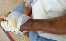 Cảnh báo nguy cơ rắn lục đuôi đỏ tấn công