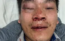 Lái xe buýt bị hành hung phải nhập viện cấp cứu