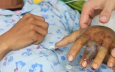 Rắn cắn nguy hiểm: Không đắp lá, không chữa mẹo