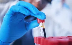 Xét nghiệm máu có thể dự báo nguy cơ biến chứng ở người mắc bệnh cơ tim phì đại