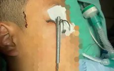 Cảnh báo nguy cơ chấn thương mắt khi đi câu cá