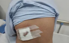 Hoại tử vùng lưng do tự chữa mụn nhọt bằng đắp lá