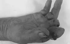 Cẩn trọng tai nạn sinh hoạt từ thiết bị gia dụng