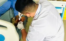 Dị vật bàn chân: Chậm điều trị dễ biến chứng nặng