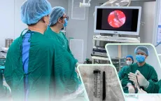 Ca cấp cứu nguy hiểm: Dị vật đâm xuyên hốc mắt vào nền sọ