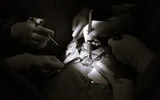 Đi khám vì nuốt vướng, phát hiện mắc ung thư tuyến giáp