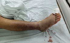 Cảnh báo rắn lục đuôi đỏ cắn gây rối loạn đông máu nguy hiểm