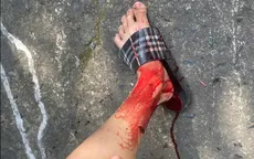 TP Hồ Chí Minh: Thêm nhiều nạn nhân bị khỉ tấn công trên Núi Lớn Vũng Tàu