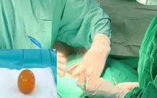 Bé gái 18 tháng tắc ruột nguy kịch do nuốt hạt nở đồ chơi