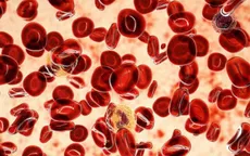 WHO: Có thể phòng ngừa 40% số ca ung thư trên toàn cầu