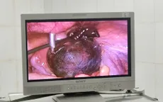 Cấp cứu kịp thời u nang buồng trứng xoắn ở sản phụ đang nuôi con bú