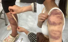 Tạm giữ người đàn ông trói, đánh con ruột, hành hạ vợ mang thai ở Bắc Ninh