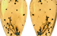 Hé lộ manh mối về nguồn gốc của bệnh u xương