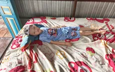 Cậu bé An Giang mang dị tật tim bẩm sinh nặng cần được tiếp sức phẫu thuật