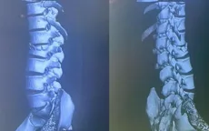 Tai nạn lao động và hiểm hoạ sức khoẻ