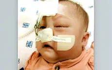 Từng nhịp tim yếu ớt của bé Hân là từng ngày gia đình thấp thỏm lo âu