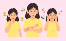 Infographic: Dị ứng thời tiết: Ai dễ mắc và cách phòng tránh?