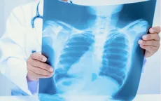 TP Hồ Chí Minh triển khai chiến dịch sàng lọc lao chủ động tại cộng đồng năm 2026