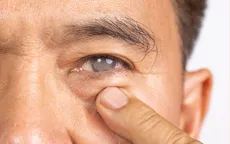 5 cách giúp phòng ngừa bệnh Glôcôm