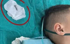 Nguy hiểm: Bé 6 tuổi nuốt ốc vít sắc nhọn