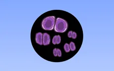 Bệnh viêm màng não do não mô cầu nguy hiểm ra sao?