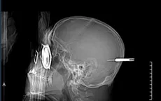 Cảnh báo nguy cơ chấn thương khi tham gia lễ hội