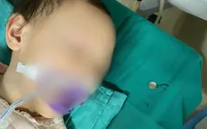 Nội soi gắp dị vật kim loại, cứu sống bé 3 tuổi