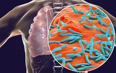 Infographic: Bệnh lao và các yếu tố làm tăng nguy cơ mắc bệnh lao